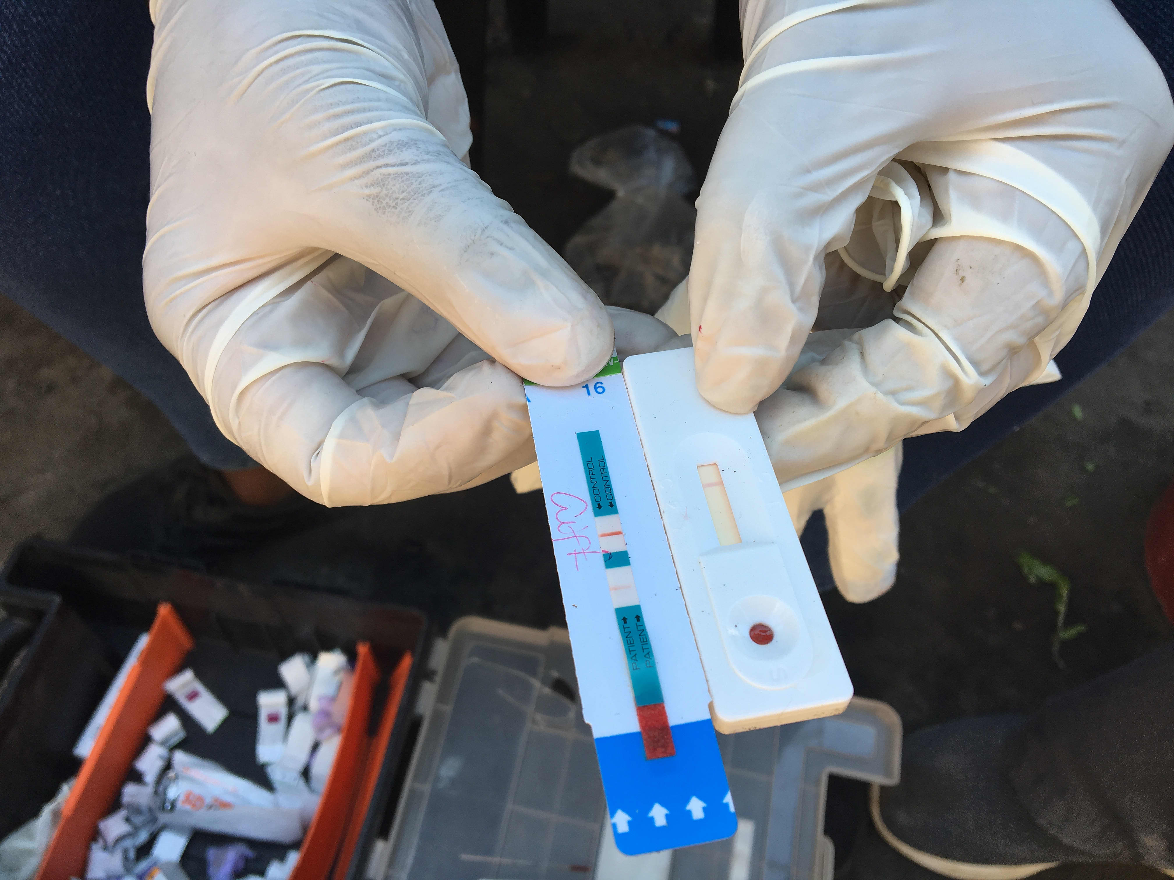 HIV test strips